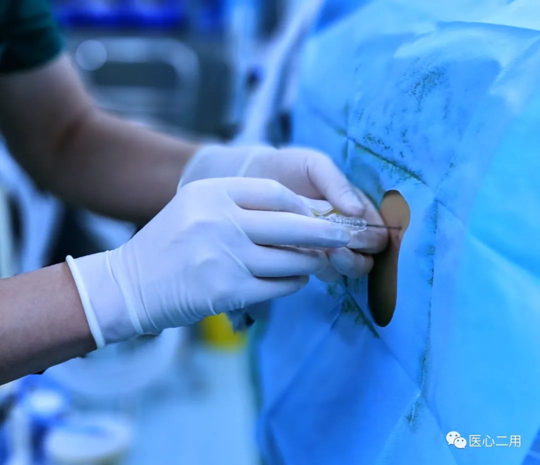 不要辩解,麻醉医生亲自承认,麻醉就是打一针……(图3)